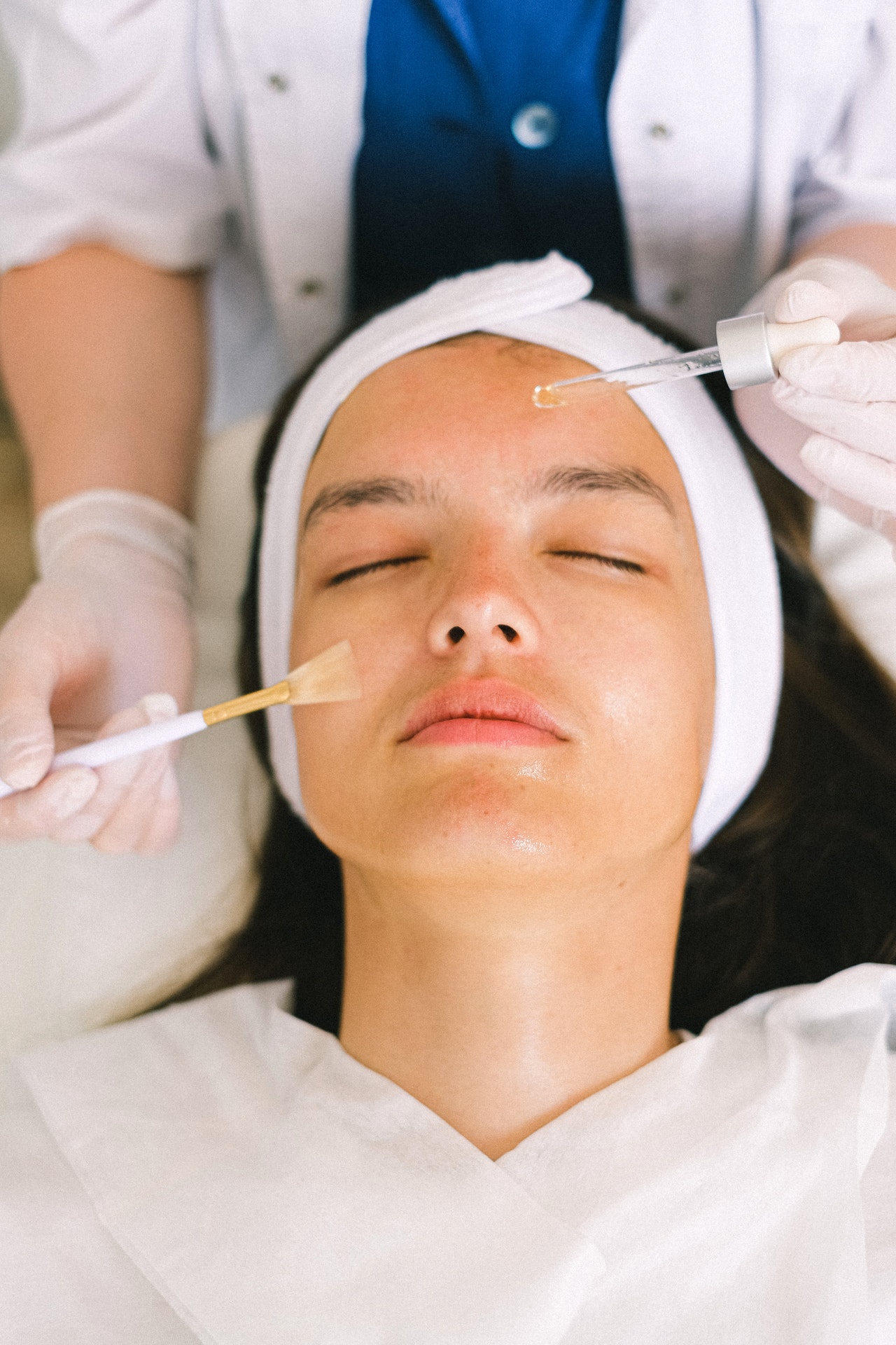 Chemical Peel | Kerrisdale Skin Medical