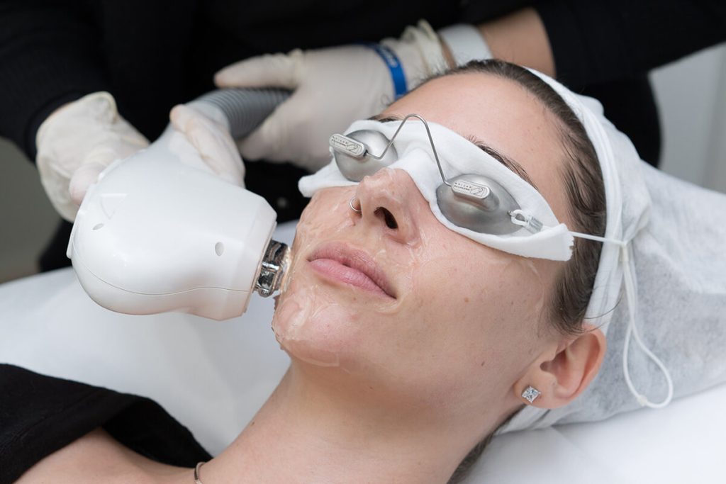 Ipl Skin Rejuvenation Kerrisdale Skin Medical 4864