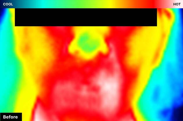 Infrared image showing warm, red areas before applying